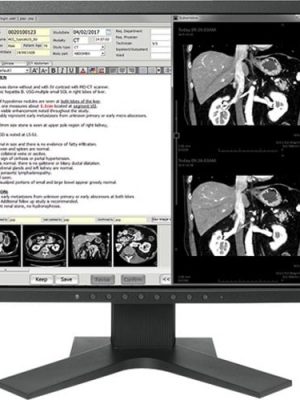 19IN CLR TFT LCD DICOM CALIBRATION
