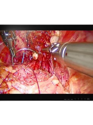 26IN 1920X1080 1400:1 EX2620-3D MEDICAL GRADE IPS LED MONITOR