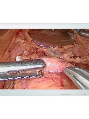 26IN 1920X1080 1400:1 EX2620 FULL HD MEDICAL GRADE IPS LED