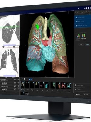 MX-SERIES 24.1IN LCD LED COLOR DICOM CALIB BLK